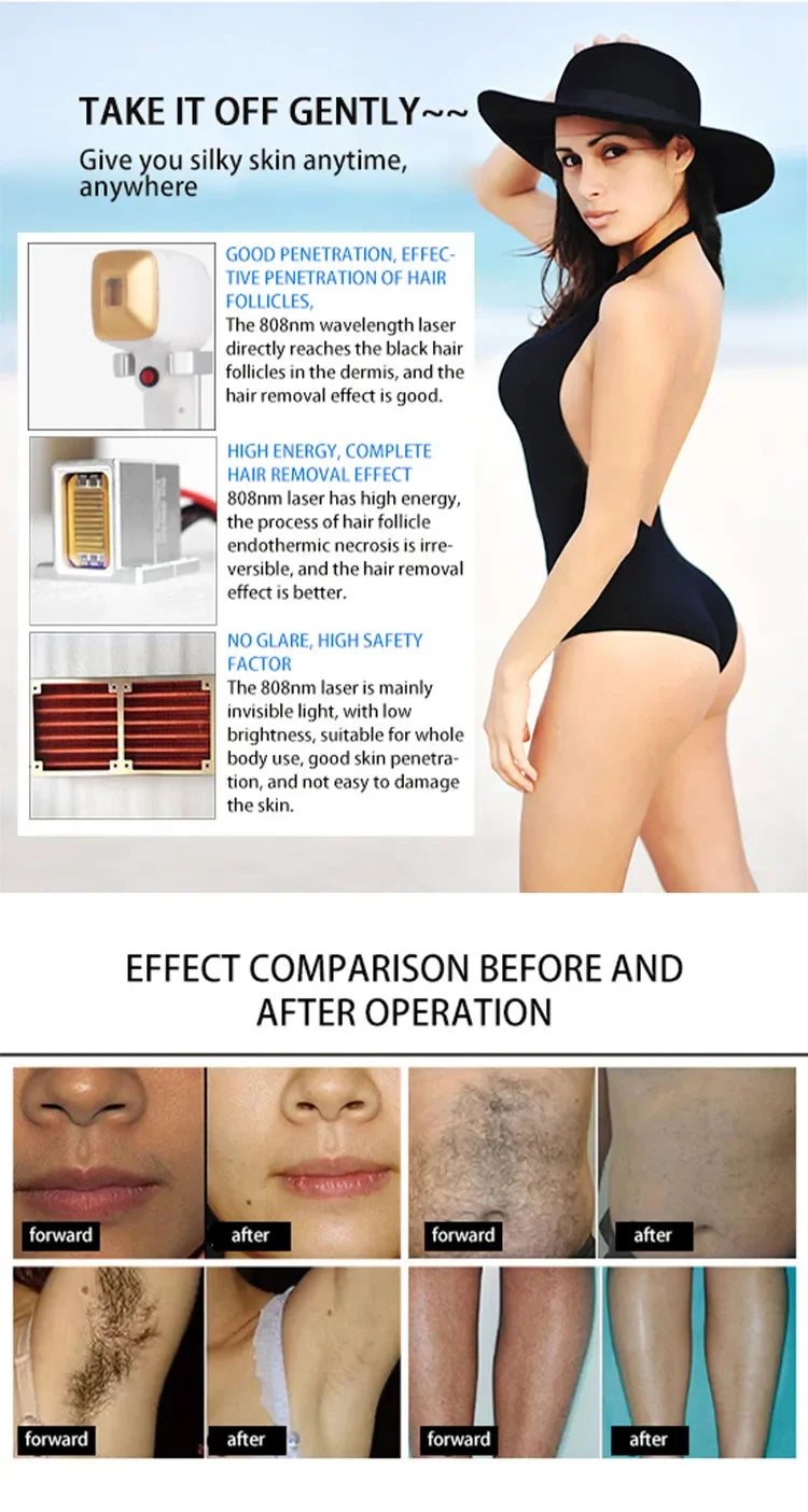 2026 Professional Alexandrite Laser Hair Removal 755 808 940 1064nm Diode Laser Epilation Portable Laser Hair Removal Machine
